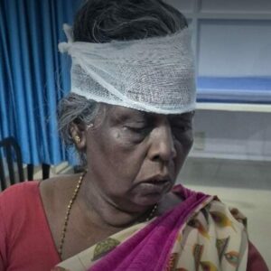 നാദാപുരത്ത് കാട്ടുപന്നി ആക്രമണത്തില്‍ വയോധികയ്ക്ക് പരിക്ക്‌